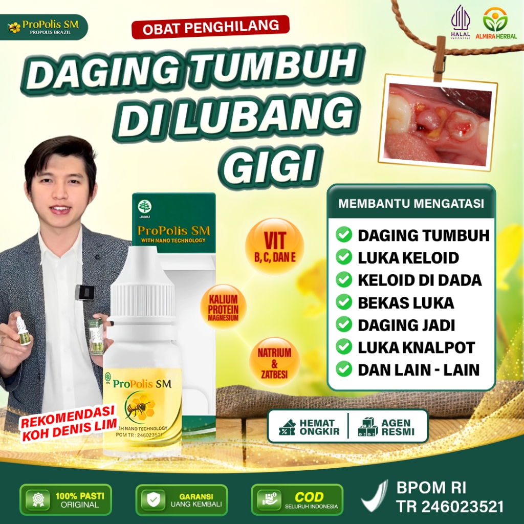 Obat Polip Gigi, Penghilang Daging Tumbuh, Polip Gusi, Gusi Bengkak, Polip Pulpa - Propolis SM
