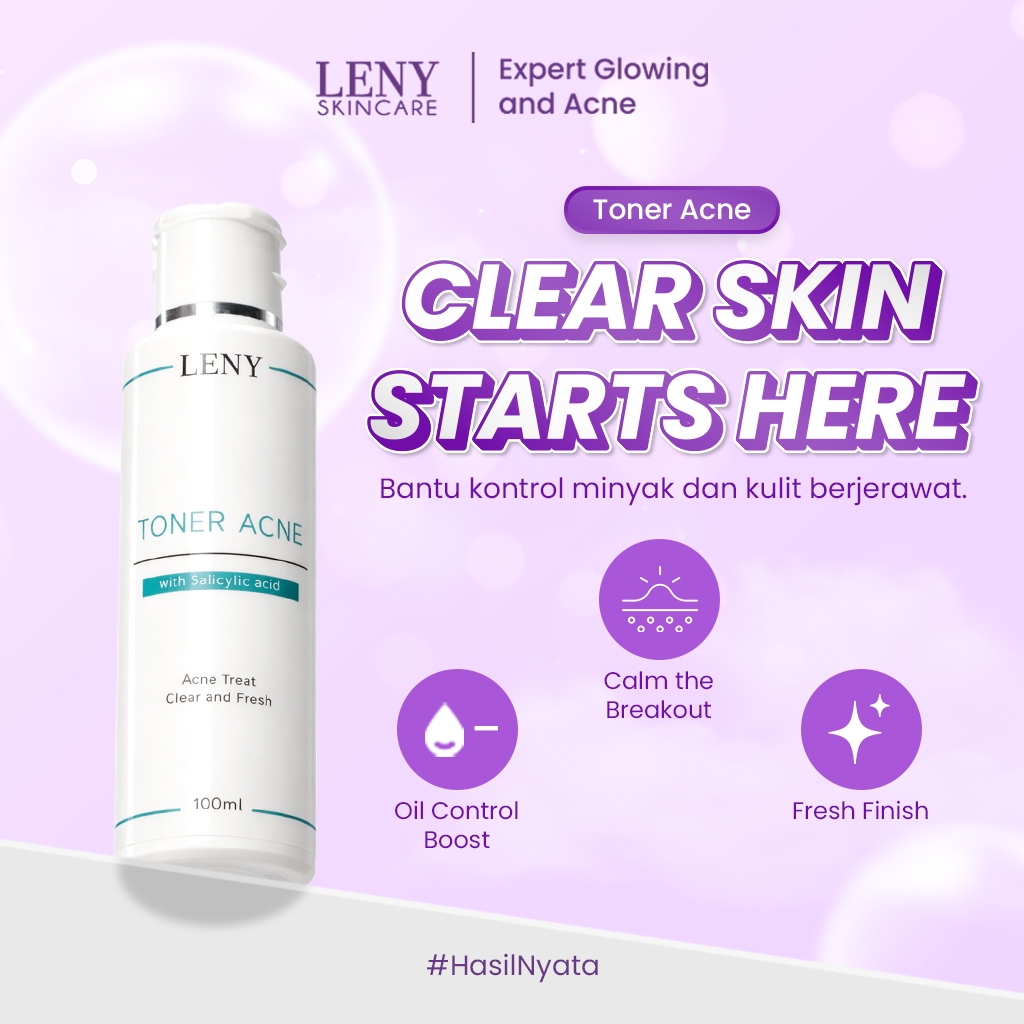 LENY SKINCARE Toner Acne 100ml Toner Jerawat & Kontrol Minyak