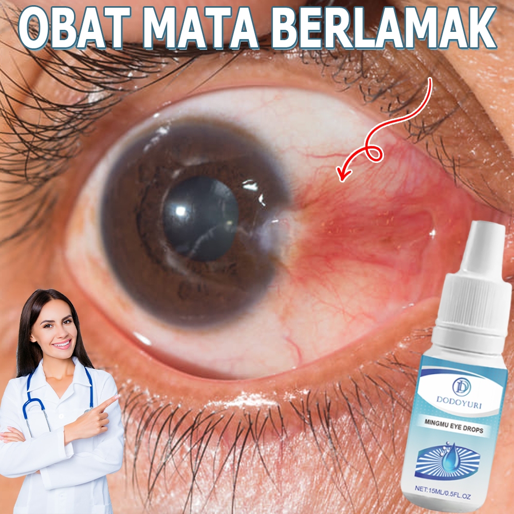 Obat tetes mata obat mata katarak obat tetes mata katarak tetes mata minus paling ampuh 15ml Tetes m