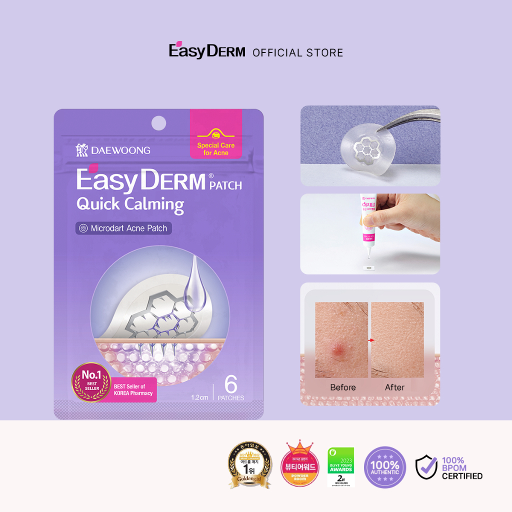 EasyDerm Beauty Quick Calming (8 pcs) - Magnesium Acne Patch Jerawat Korea BPOM
