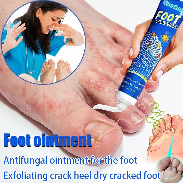 Salep Antijamur Kaki Penghilang Bau dan Gatal Krim Antibakteri Tinea Pedis Pembersih Kulit Mati