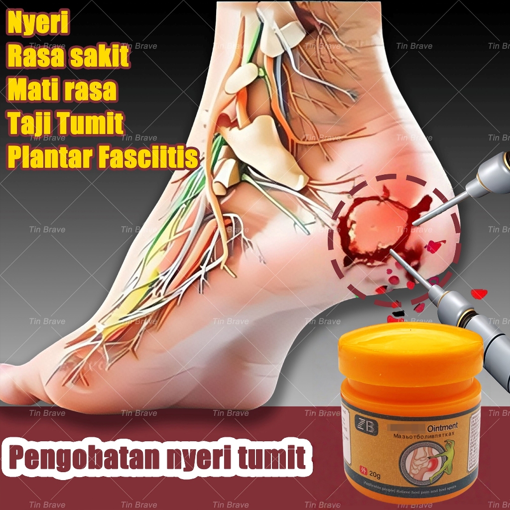obat sakit tumit obat kaki bengkak plantar fasciitis terapi krim sakit tumit sakit tumit kaki alat k