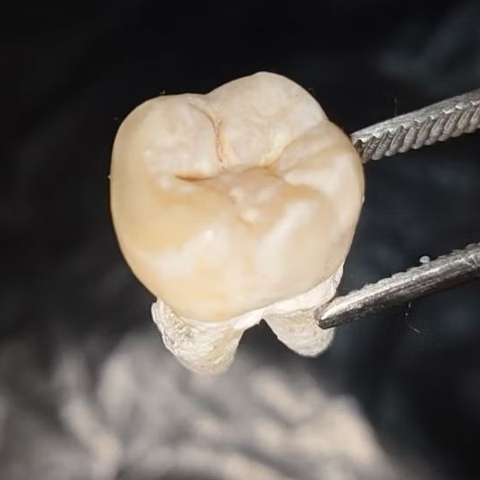 GIGI MOLAR ASLI UNTUK PRAKTIKUM