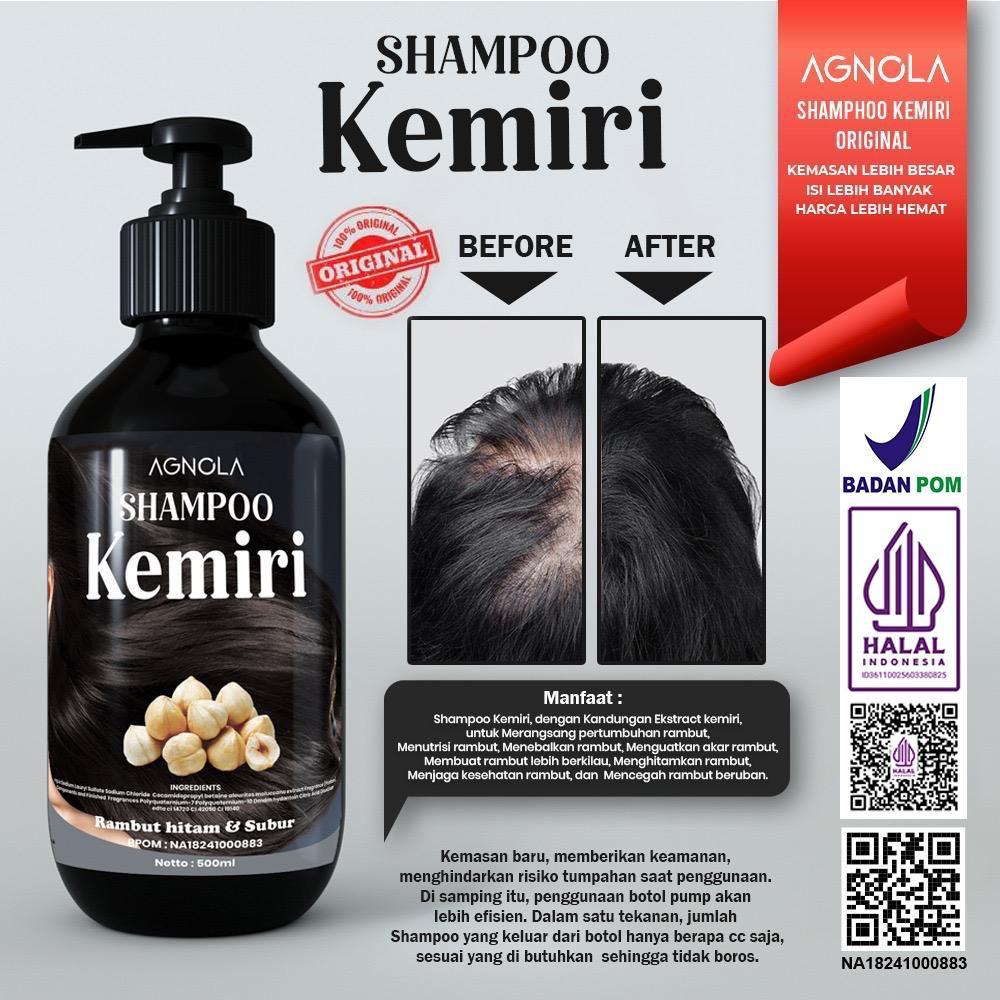 [ BPOM & HALAL ] Shampo Kemiri Penumbuh Rambut Cepat Anti Ketombe Penghilang Uban dan Rontok - 500ml