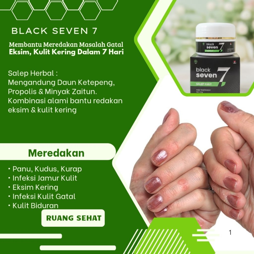 BLACKSEVEN 7 Salep Herbal Dengan Ekstrak Daun Ketepeng | Redakan Kulit Kering Gatal, Mengelupas Dan 