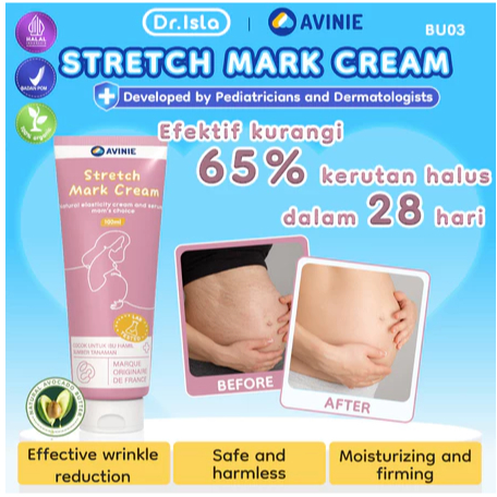 Avinie Stretch Mark Cream / Krim Pemudar Stretch Mark / Cream Aman Mengatasi Stretch Mark