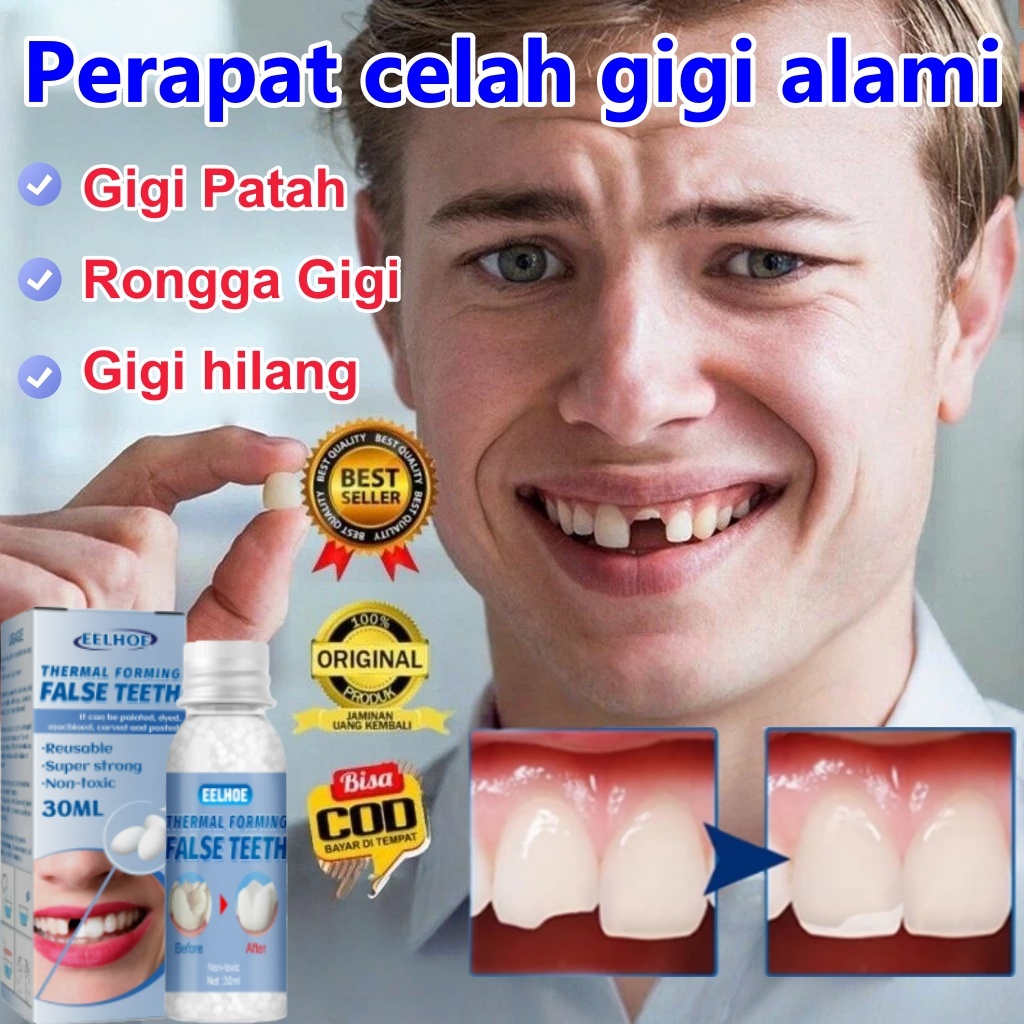 Lem Gigi Palsu Permanen Tambal Gigi Berlubang Temptooth Penambal Gigi Tambalan Gigi Penambal Gigi Be