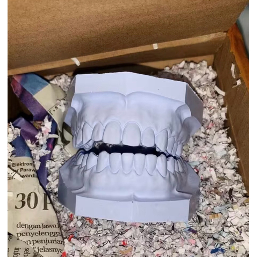 Model gigi gips/ Study model gigi gips