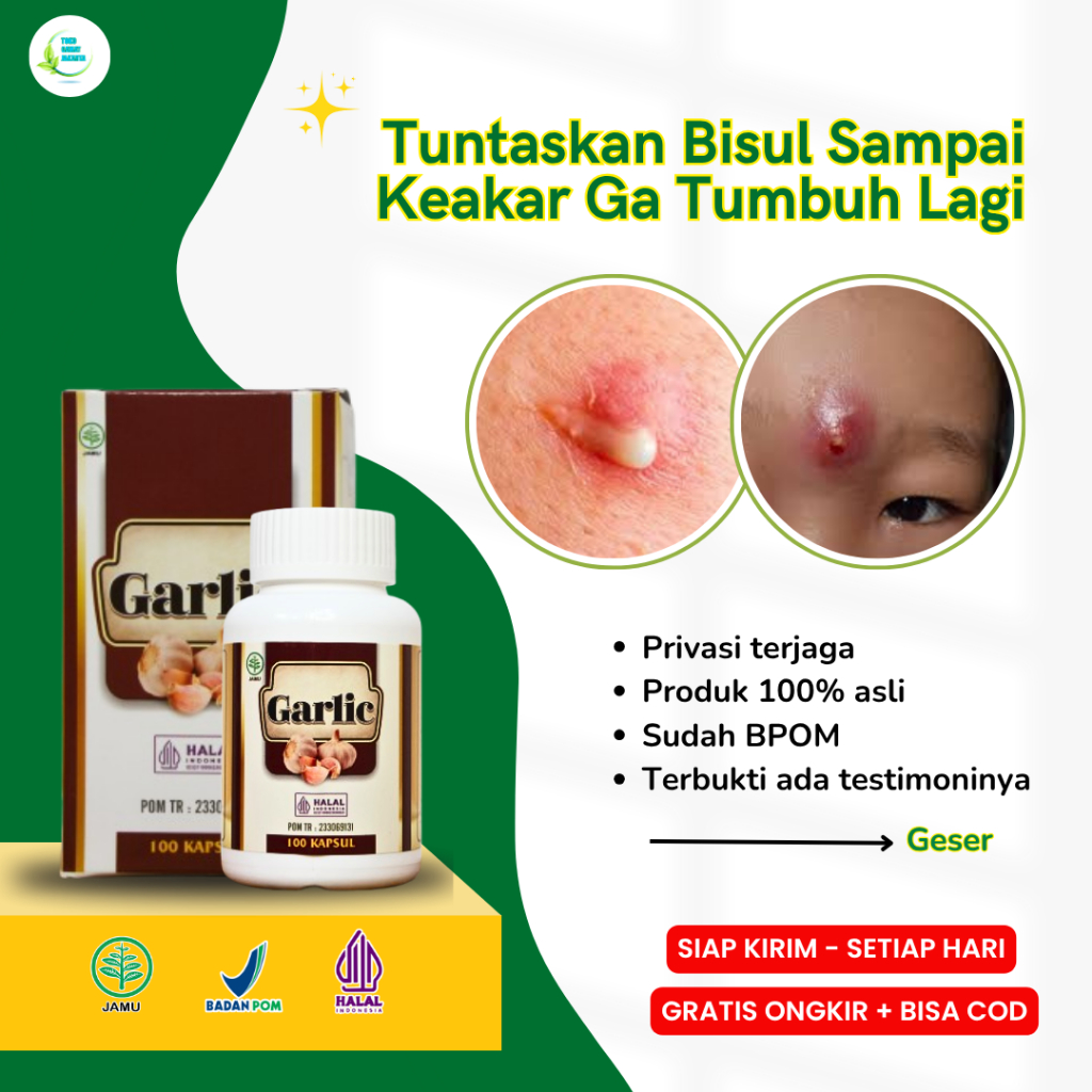 Obat Bisul Agar Tidak Tumbuh Lagi, Obat Bisul Tradisonal Agar Cepat Pecah, Obat Bisul Tanpa Mata