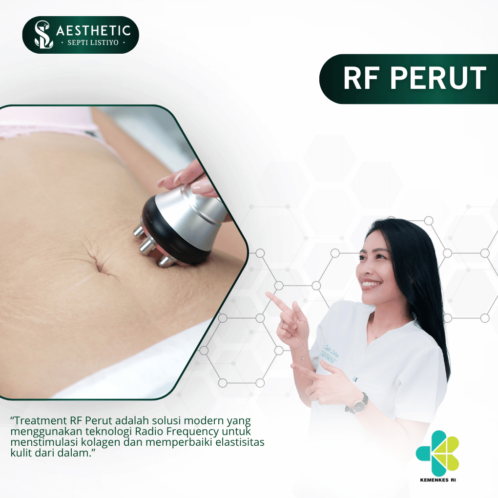 E - Voucher RF Perut – Treatment Pengencang & Pelangsing Area Perut