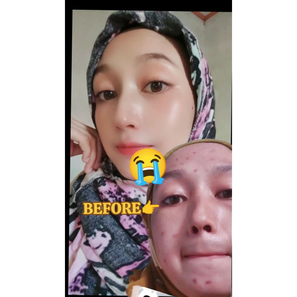 RA Glow SKINCARE by. NAFKU