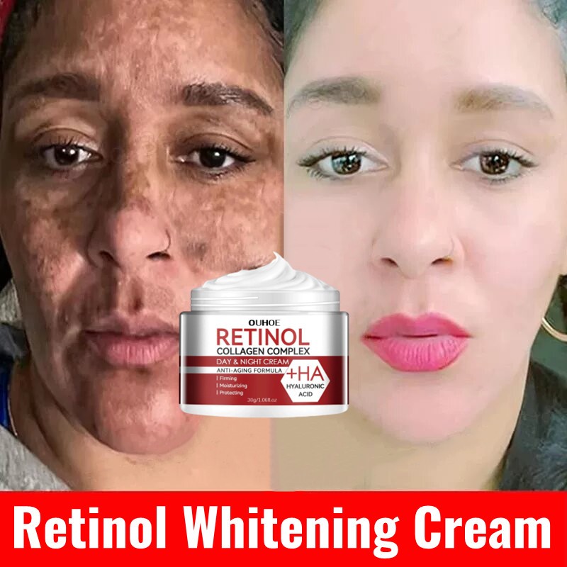 Retinol whitening cream Retinol flek hitam membandel Retinol cream glowing Cream retinol untuk flek 
