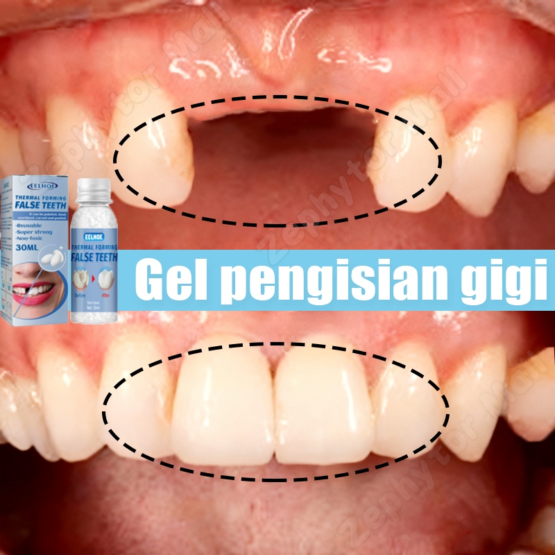 penambal gigi berlubang 30ml butiran penambal gigi tambal gigi permanen lem gigi palsu permanen buti