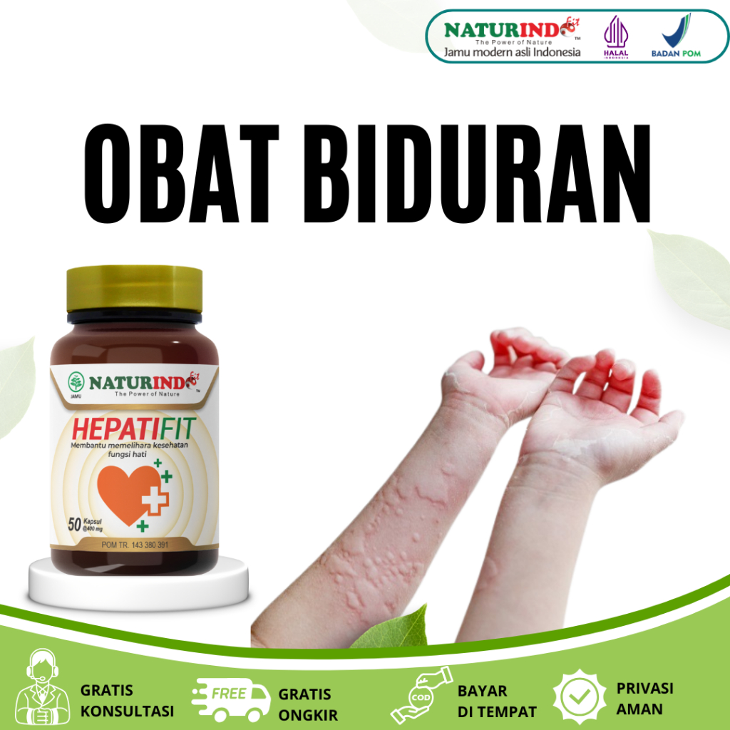 Obat Biduran Alergi Dingin Alergi Panas Biang Keringat Gatal-gatal Ruam Kulit Hepatifit Naturindo