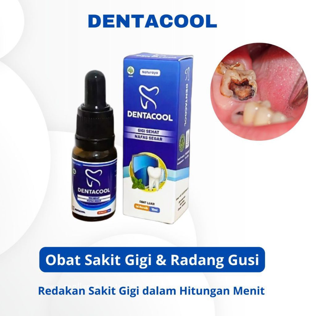 DENTACOOL Obat Sakit Gigi Manjur Obat Sakit Gigi Tetes ORI 10 Ml
