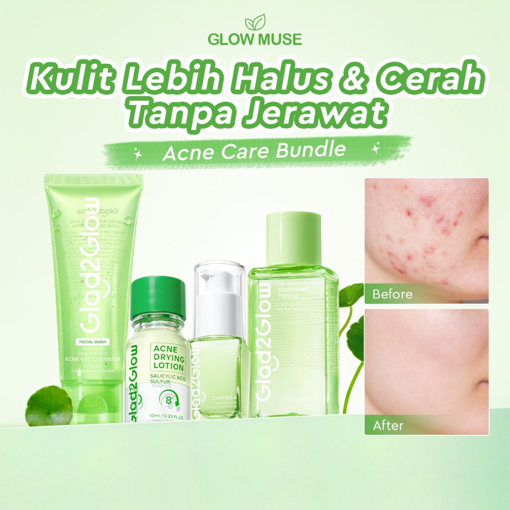 [100% ORI]Glad2Glow Acne Care bundle all in 1 - 2/3/4/5/6 PCS Skincare Paket-Soothing toner+Centella