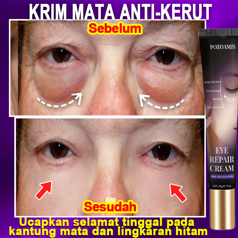 Eye-cream-kantung-mata-penghilang-kantung-mata-panda-dan-kantung-mata-ampuh-penghilang-mata-panda-20