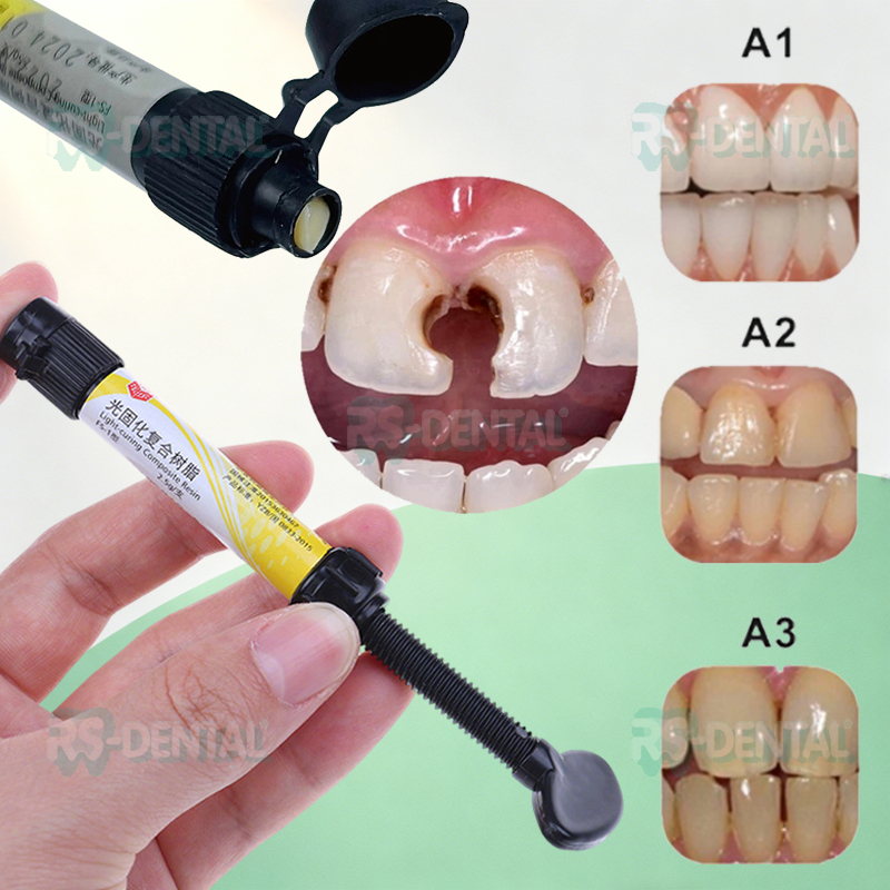 Microhybrid Nanofill Composite Komposit Bahan Tambal Gigi Veneer - Bahan Restorasi Light Cure Laser 