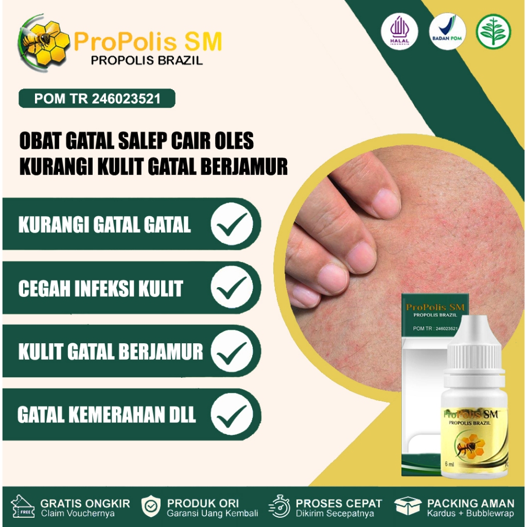 Obat gatal obat salep gatal caair propolis sm obat gatal kulit alami obat gatal di apotik untuk gata