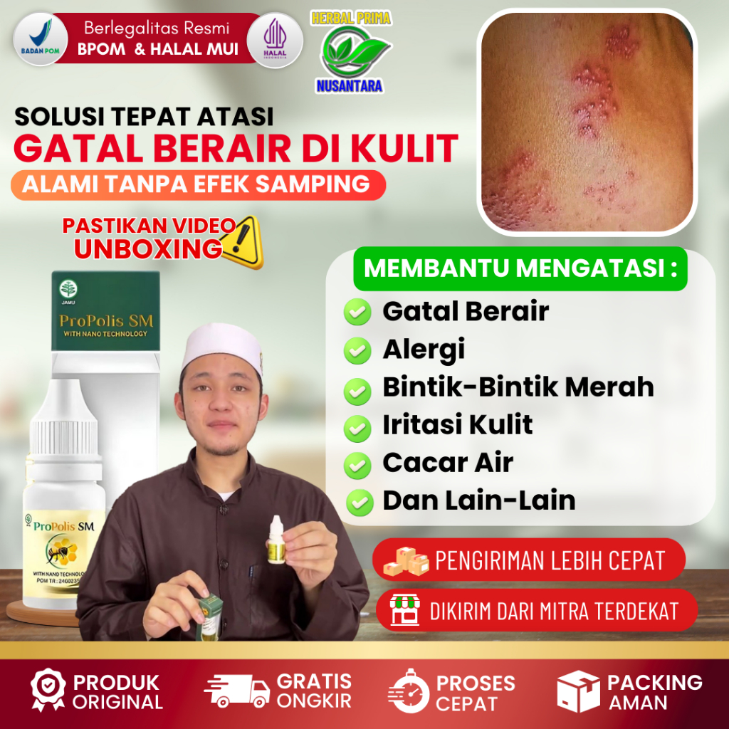 Obat Tetes Gatal Berair di Jari Tangan dan Kaki - Obat Bintik Bening, Berair, Gatal, Bernanah - Obat