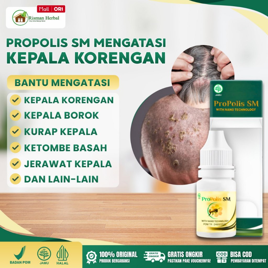 Propolis sm Obat Borok Di Kepala, Korengan, Kulit Kepala Bersisik Berkerak Infeksi Jamur