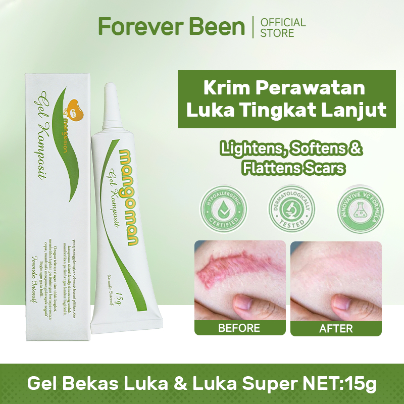 BPOM Krim Perawat Luka Lanjutan untuk Ibu: Menghilangkan Bekas Caesar, Bedah Mata, Luka Lama, Stretc