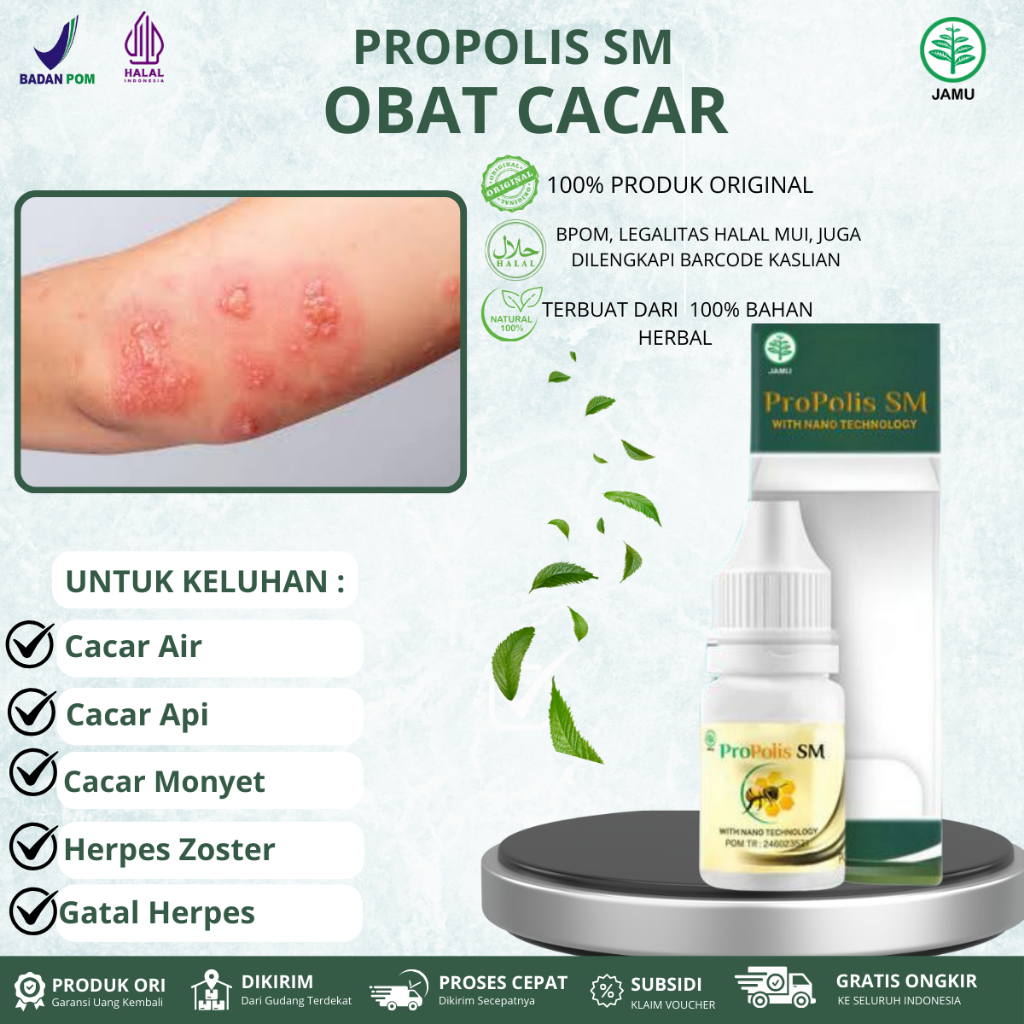 Propolis SM Untuk Cacar Air, Herpes Zoster,Penghilang Bekas Cacar, Gatal Berair Ruam Kulit