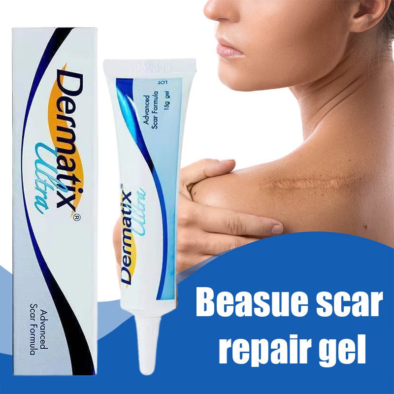 Dermatix Ultra Cream Penghilang Bekas Luka 15gr