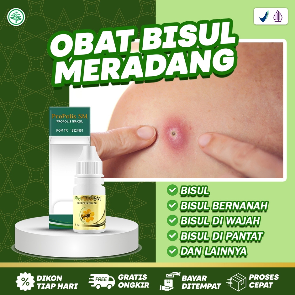 Obat Bisul Obat Bisul Meradang Obat Bisul di Pantat Obat Pengempes Bisul Obat Bisul Bernanah Obat Bi
