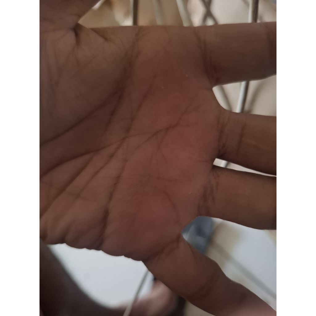 HANDLE KOPLING J JUAN HANDLE KIRI JJUAN universal