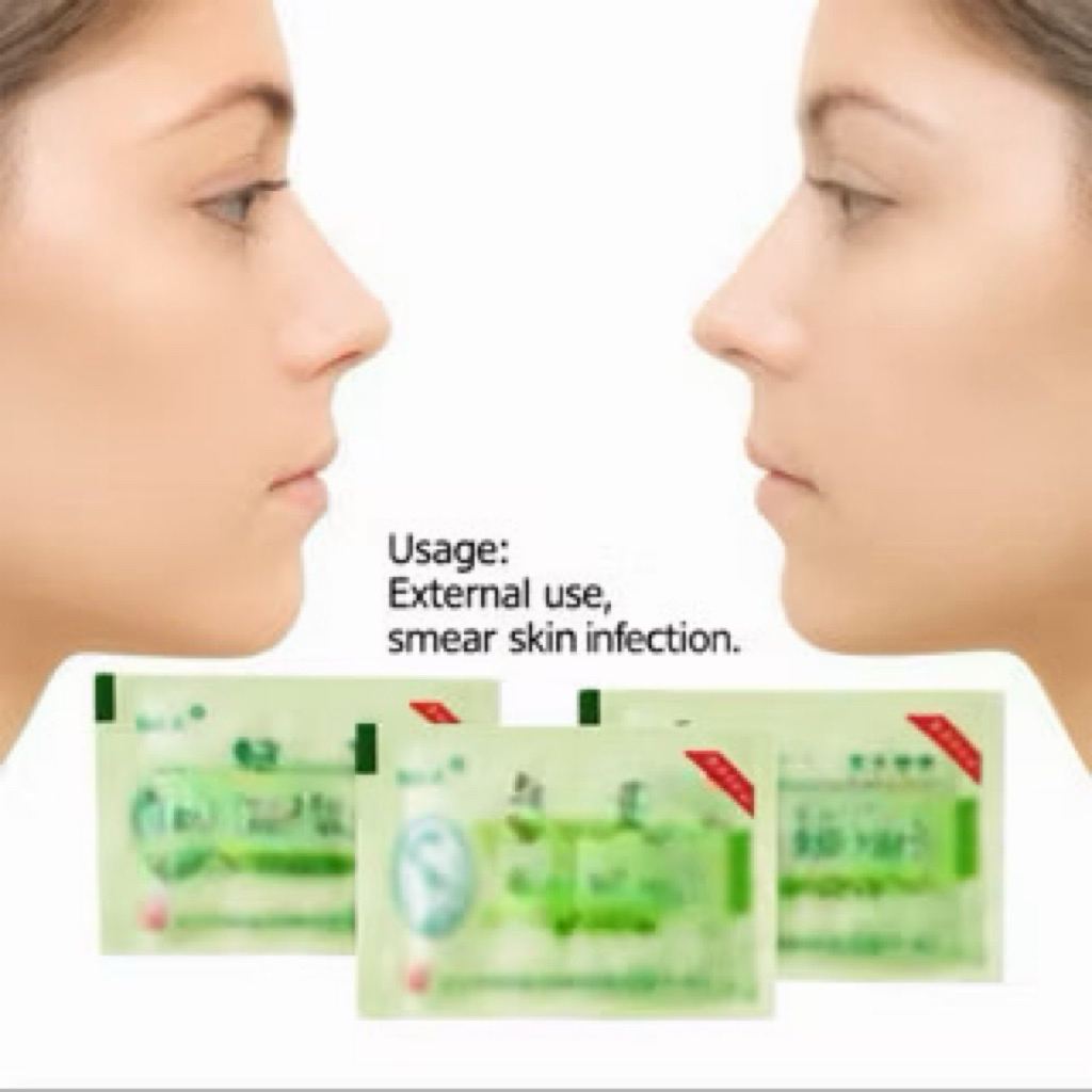 Salap gatal gatal sachet ampuh