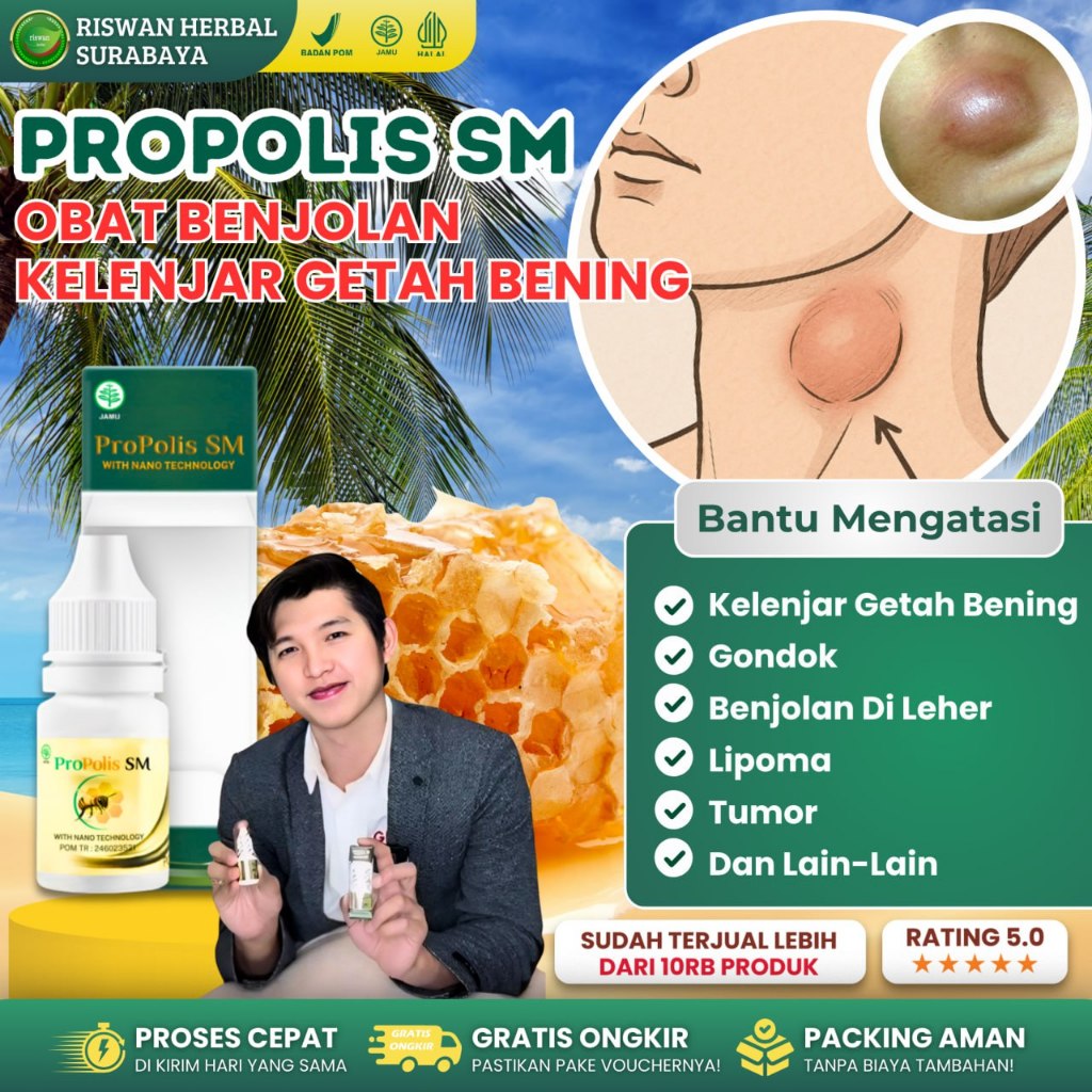 OBAT TB KELENJAR GETAH BENING TBC KELENJAR HERBAL PROPOLIS SM ORIGINAL