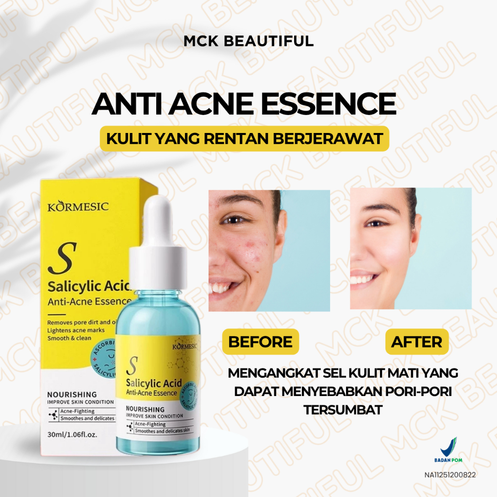 KORMESIK Esensi anti-Jerawat asam salisilat