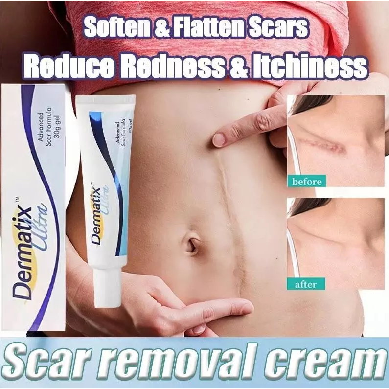 Dermatix Ultra 15gr Penghilang Bekas Luka Merawat dan memudarkan Bekas Luka - Bisa Menghilangkan Bek