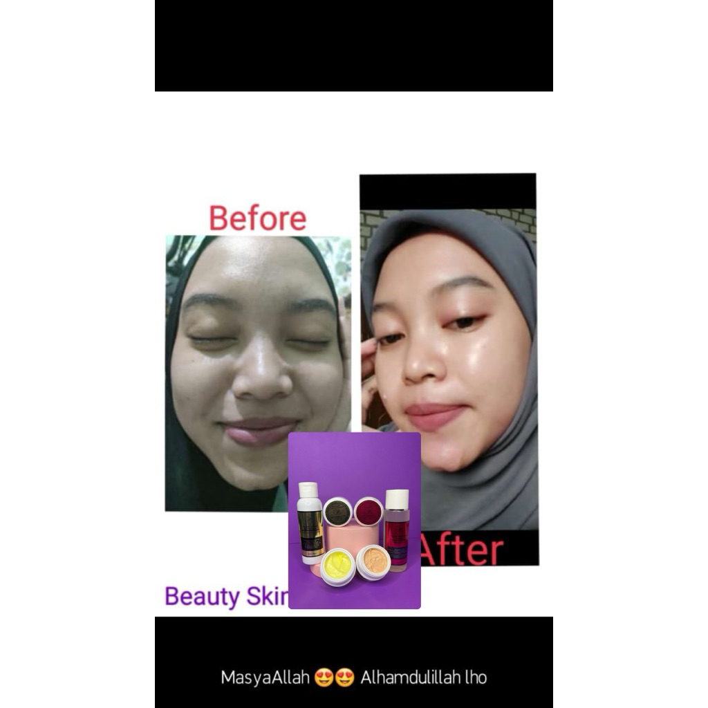 BSC SKINCARE / CREAM MALAM GLOW/ SALEP FLEK/CREAM DOKTER