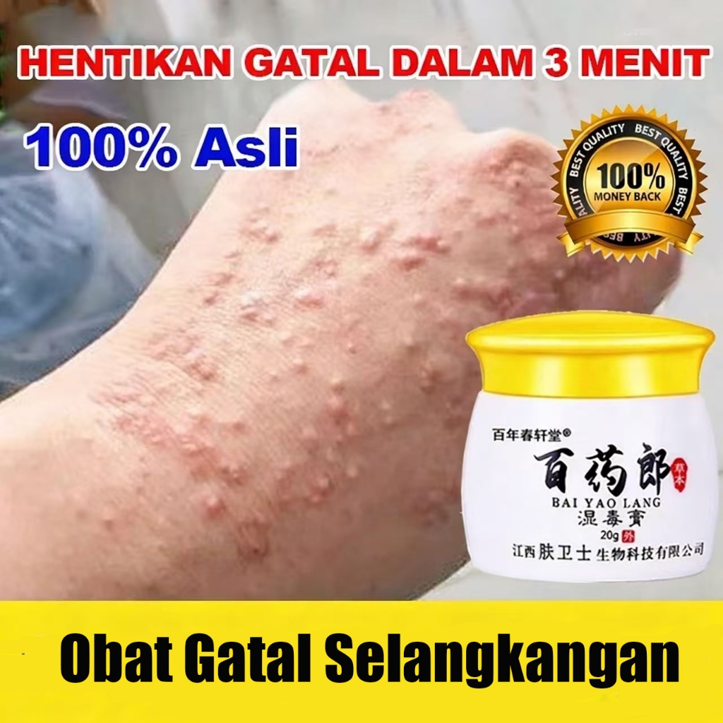 Salep Eksim Kering dan Gatal Salep Gatal China Paling Ampuh Obat Gatal Selangkangan Salep Bayi Untuk
