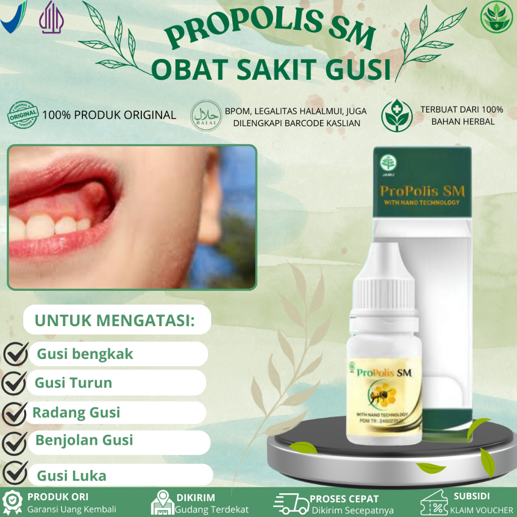 Propolis SM Untuk Sakit Gusi, Gusi Bengkak, Gusi Berdarah, Gusi Turun, Abses Gusi, Polip Gusi, Infek