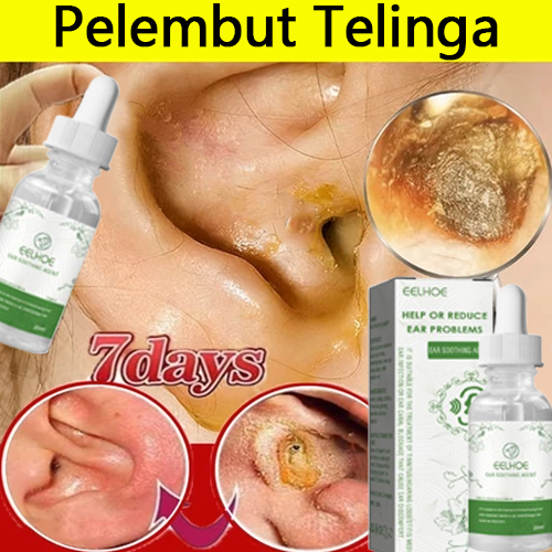 Mooncy Obat Tetes Telinga Pembersih Kotoran Pembersih Telinga Bayi Obat Sakit Telinga Bernanah Berai