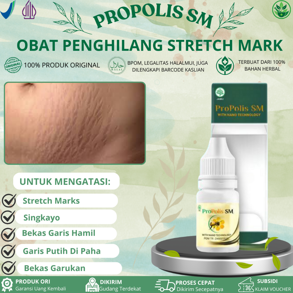 Obat Penghilang Stretch Mark, Bekas Garis Hamil, Stretch Mark Di Perut, Paha, Leher, Betis, Garis Hi