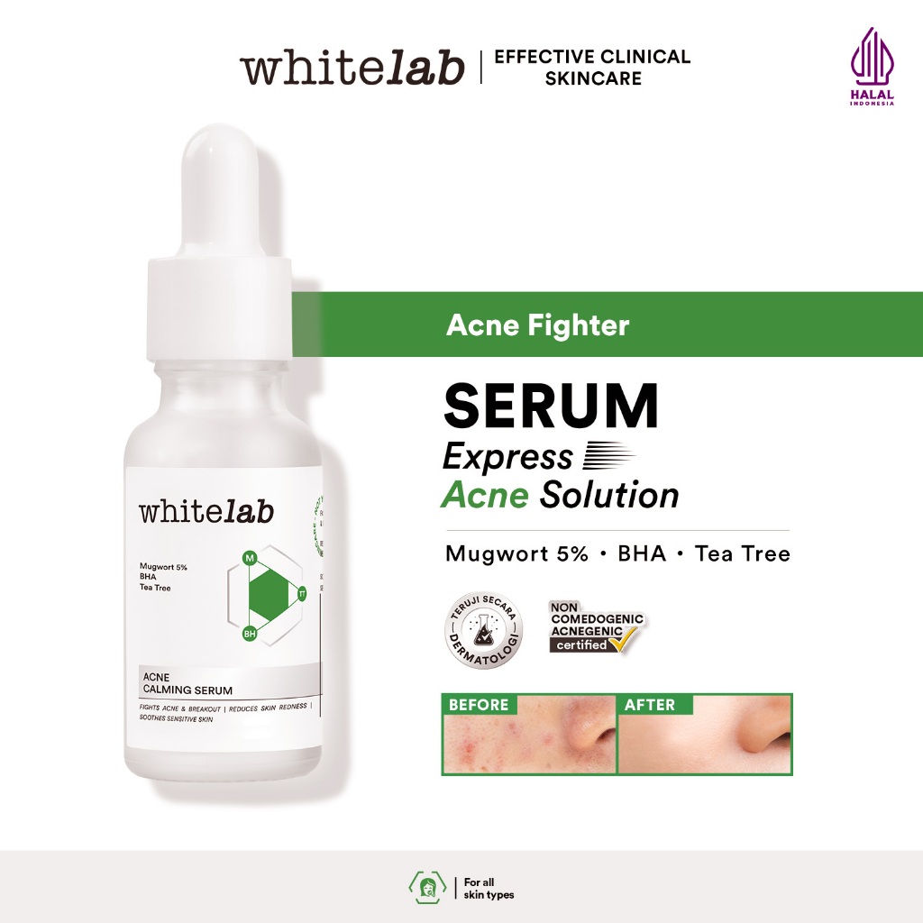 Whitelab Acne Calming Serum - Serum untuk Kulit Jerawat, Bruntusan, dan Berminyak dengan Mugwort, BH