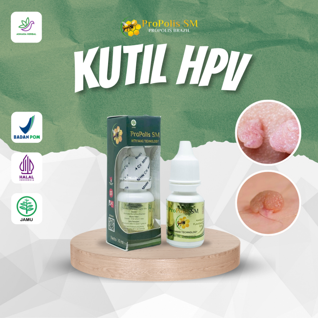 Propolis SM - Perontok Kutil Kelamin HPV, Kutil Anus Pria Wanita, Perontok Papiloma