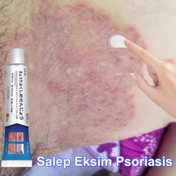salep gatal selangkangan Saleb gatal paling ampuh Salep Eksim Obat Kurap Anti Jamur 100% halal asli