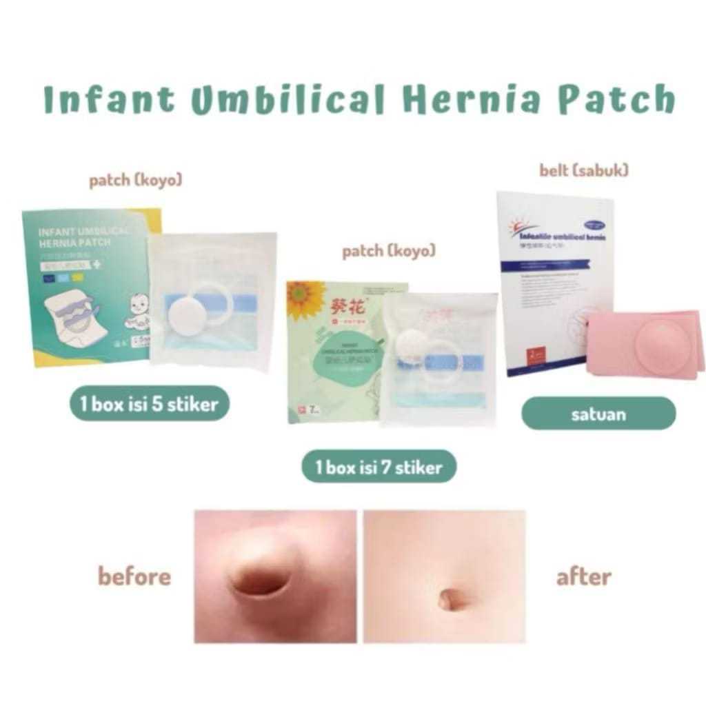 KOYO INFANT UMBILICAL HERNIA PATCH Bodong Koyo Pusar Bodong Bayi Sachet Plester Pusar Bayi Sabuk Her
