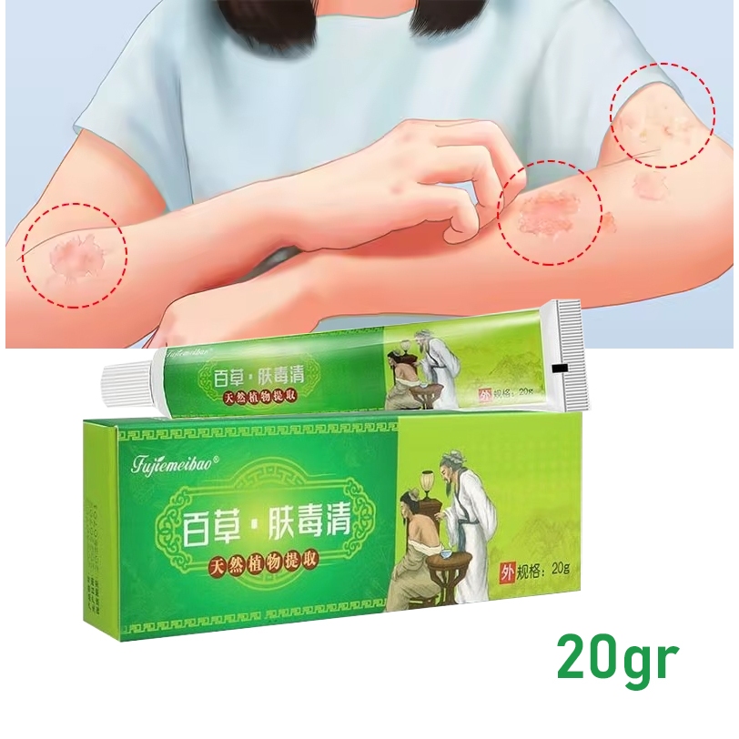 Salep Gatal Herbal Cina Paling Ampuh Obat Penyakit Kulit Eksim Alergi Jamur Kudis Kurap