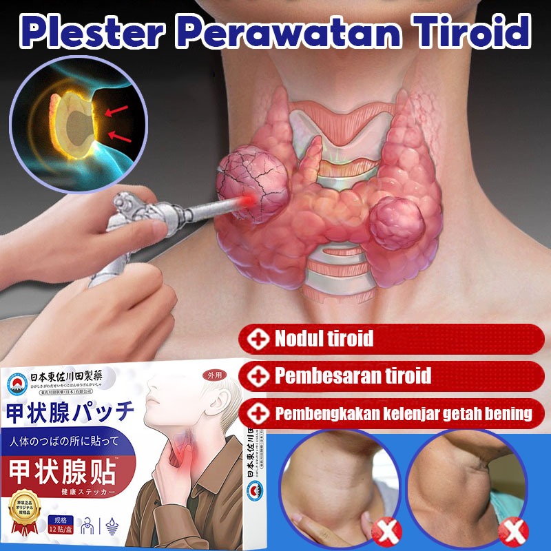 Plester Perawatan Tiroid Jepang Salep Tiroid Obat benjolan di leher Obat Gondok Obat Kelenjar Tiroid