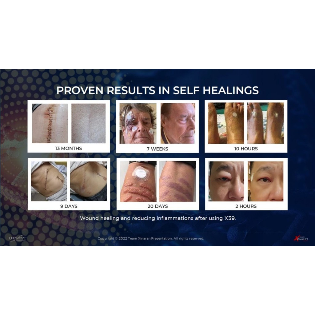 Mau Terapi Stem Cell Tapi Biaya Kemahalan? Lifewave Patch X39 Jawabannya - Tanpa obat, tanpa jarum, 