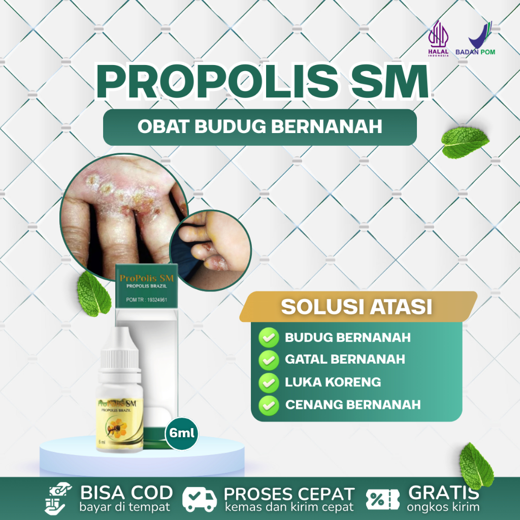 Obat Budug Bernanah, Gatal Bernanah, Koreng Bernanah, Penghilang Bekas Koreng Hitam - Propolis SM