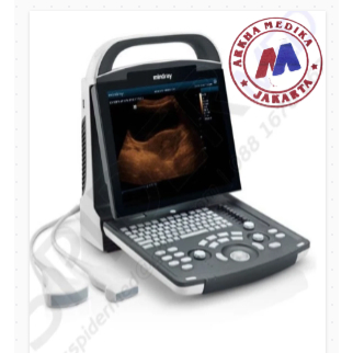 USG Mindray DP 10 Plus Probe Dan Doppler DP10 | DP-10 Ultrasonografi | USG Mindray DP 10 - 100% Orig