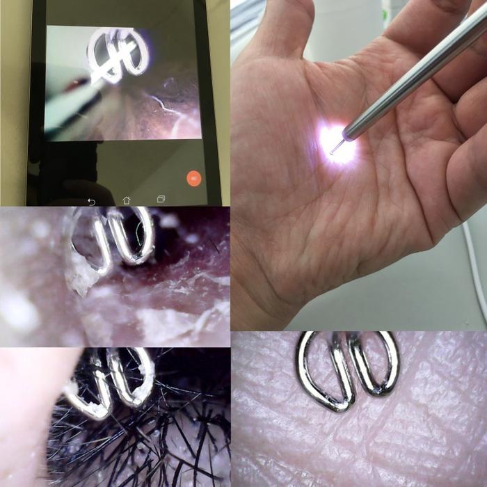 Medis Endoskopi THT + HD Camera + Lensa 4.9mm u/ HP Android & PC MURAH