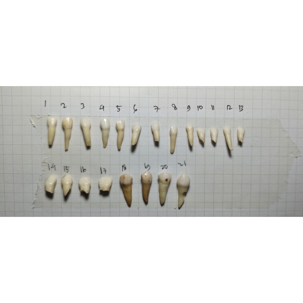 Gigi Asli | Gigi Desidui | Gigi Sulung | Gigi Anak | Gigi Praktikum